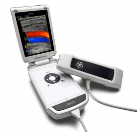 Ruční přenosný ultrazvukový systém Vscan Dual Probe