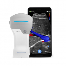 Vscan Air - revoluční ultrazvuk do kapsy